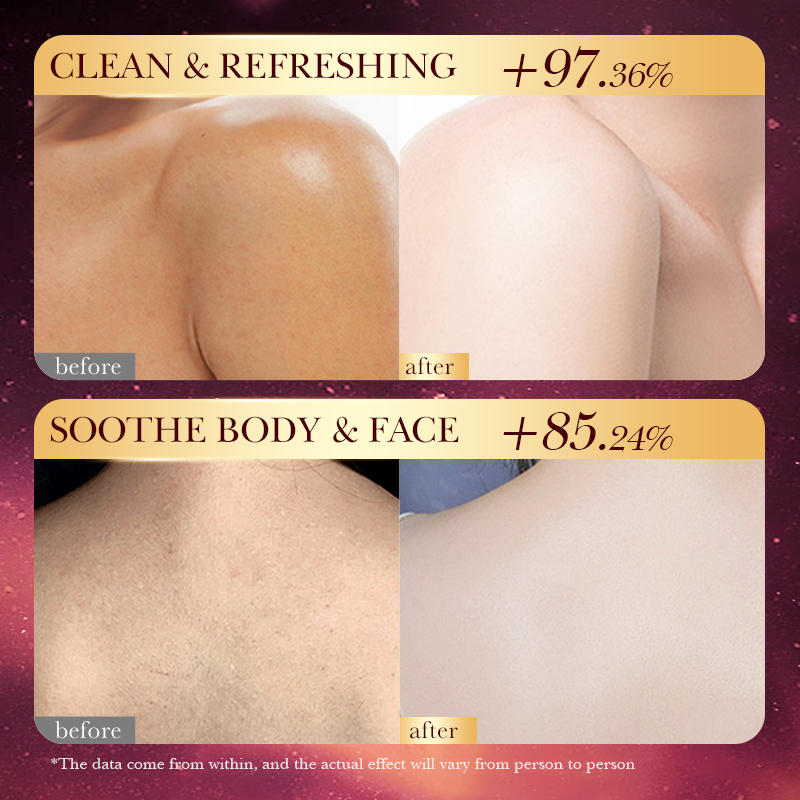 สบู่แฮนด์เมดสีโรสโกลด์ฟอยล์ –  - Luxury Rose Skincare บทวิจารณ์และราคา